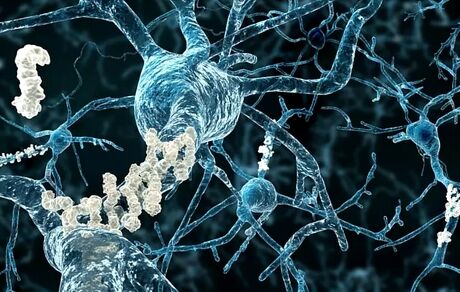 تشخیص ۱۷ سال زودتر آلزایمر ممکن شد