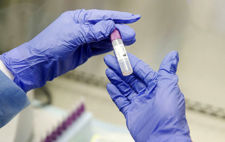 داروی تجربی کرونا در آمریکا تاییدشد