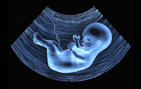 سود سالانه هزار میلیاردی مافیای «غربالگری‌» در کشور / قانون جوانی جمعیت، سد راه سودجویان