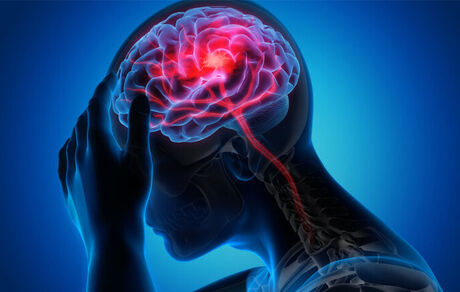 پیش‌بینی خطر سکته مغزی با آزمایش چشم