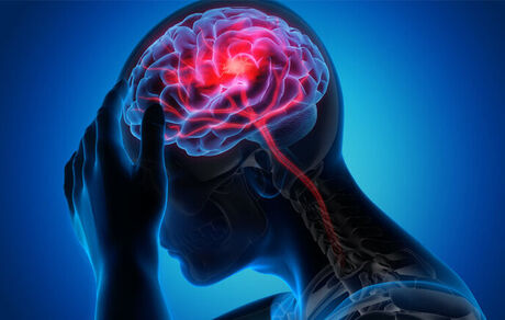 پیش‌بینی خطر سکته مغزی با آزمایش چشم