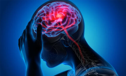 پیش‌بینی خطر سکته مغزی با آزمایش چشم