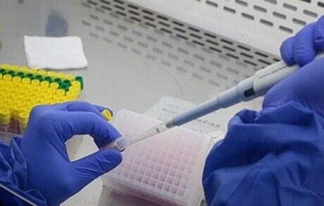 فهرست جدید آزمایشگاه‌های تشخیص کووید ۱۹ اعلام شد