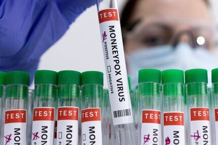 آبله میمونی به روسیه رسید