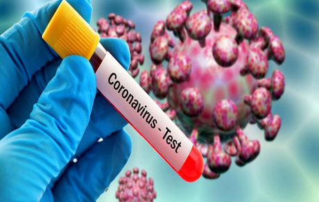 کیت تشخیص قطعی کرونا هفته آینده در کشور تولید می شود