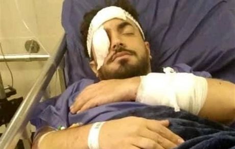 یک روحانی در تهرانپارس مورد ضرب و شتم قرار گرفت + جزئیات