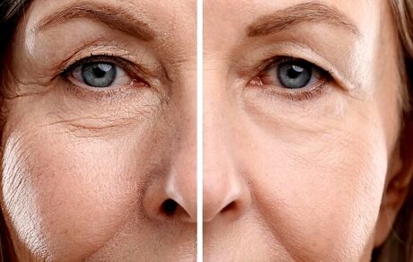 معکوس کردن پیری با تغییر رژیم غذایی ممکن شد