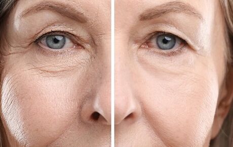 معکوس کردن پیری با تغییر رژیم غذایی ممکن شد