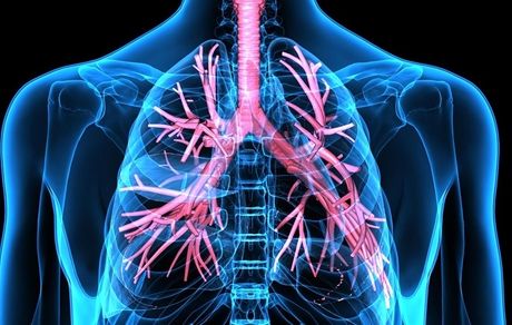 متورم شدن زیربغل، علامت غیرمنتظره سرطان ریه